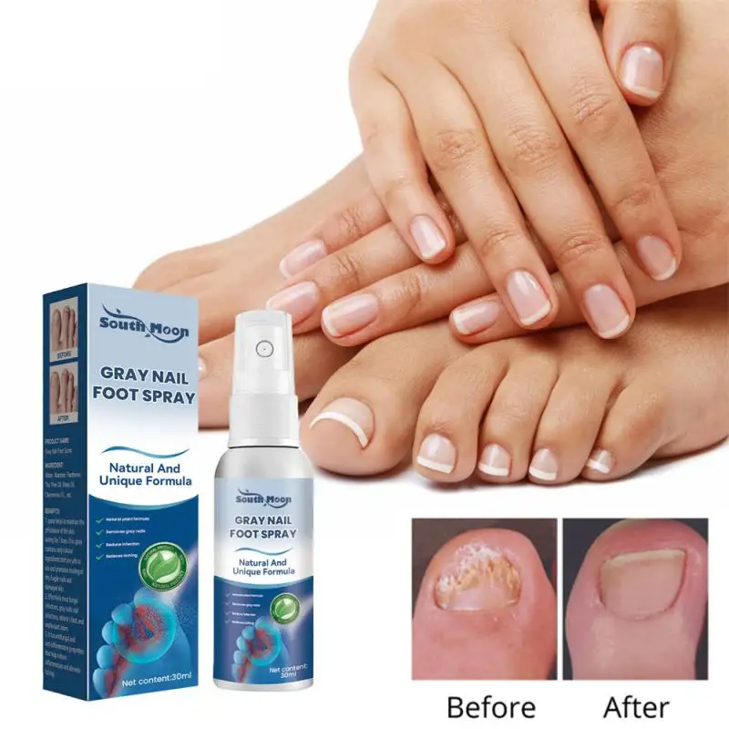 Nail Fungus Treatments Serum Spray Repair Toe Nail Fungal Removal Essence Anti-Infection Onychomycosis Paronychia Treatment
Nail Fungus Treatments Serum Spray Repair Toe Nail Fungal Removal Essence Anti-Infection Onychomycosis Paronychia Treatment