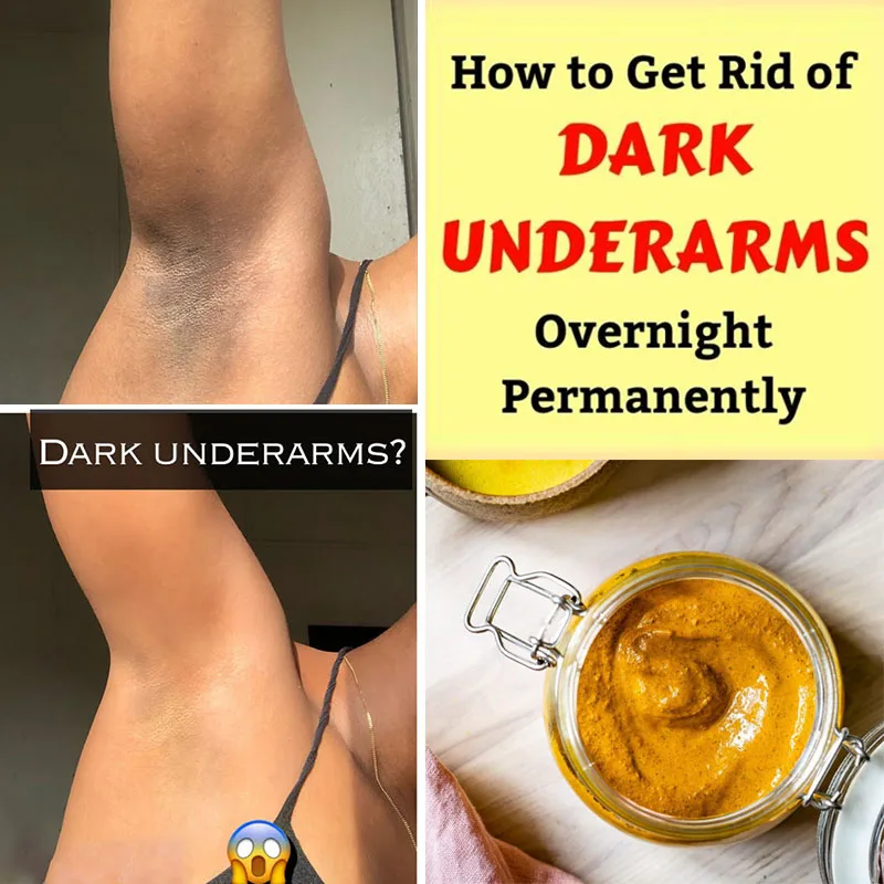 Turmeric Soap Get Rid of Dark Underarms Cleaning Armpits Curcumin Inhibit Melanin Production Exfoliating Reduce Dead Skin Cells
Turmeric Soap Get Rid of Dark Underarms Cleaning Armpits Curcumin Inhibit Melanin Production Exfoliating Reduce Dead Skin Cells