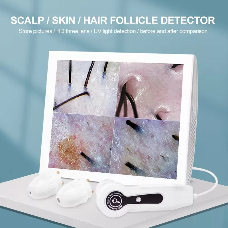 NEW 15inch LCD Scalp/Skin /Hair Follicle Detector Ultra HD UV Testing Analysis Magnifier Professional 50X/200X Skin Analyzer
NEW 15inch LCD Scalp/Skin /Hair Follicle Detector Ultra HD UV Testing Analysis Magnifier Professional 50X/200X Skin Analyzer