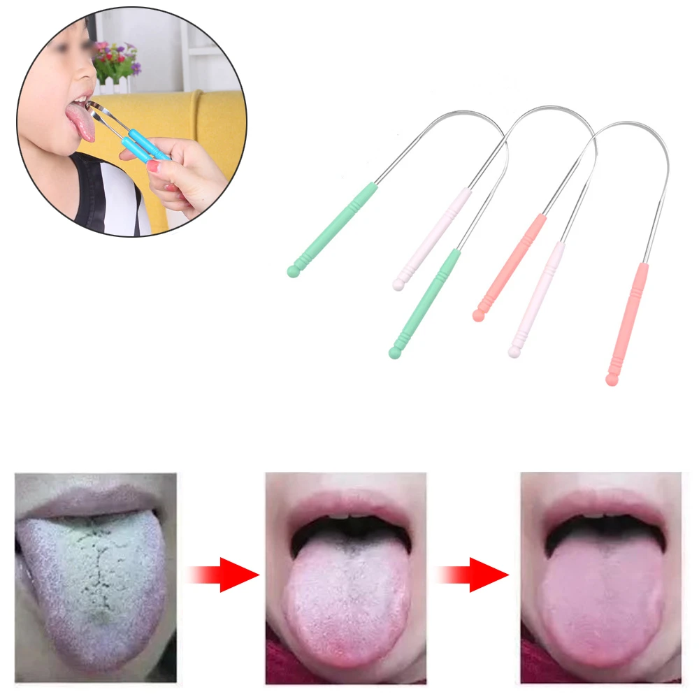 Stainless Steel Tongue Spatula Oral Hygiene Tongue Cleaner Toothbrush Oral Hygiene High Quality
Stainless Steel Tongue Spatula Oral Hygiene Tongue Cleaner Toothbrush Oral Hygiene High Quality