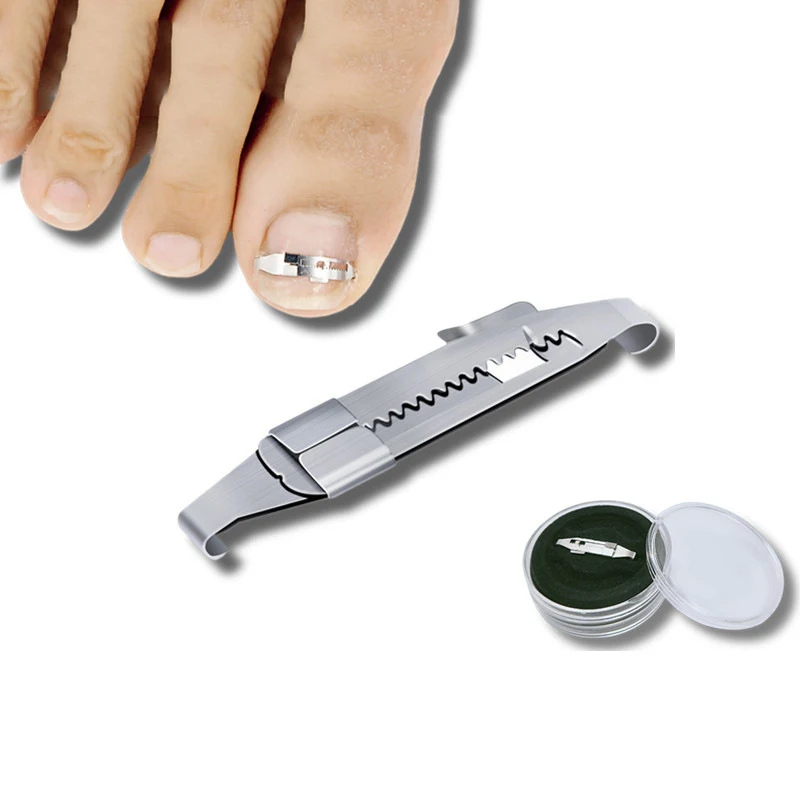 Ingrown Toenail Corrector Tools Pedicure Recover Embed Toe Nail Treatment Professional Ingrown Toenail Correction Foot Care Tool
Ingrown Toenail Corrector Tools Pedicure Recover Embed Toe Nail Treatment Professional Ingrown Toenail Correction Foot Care Tool