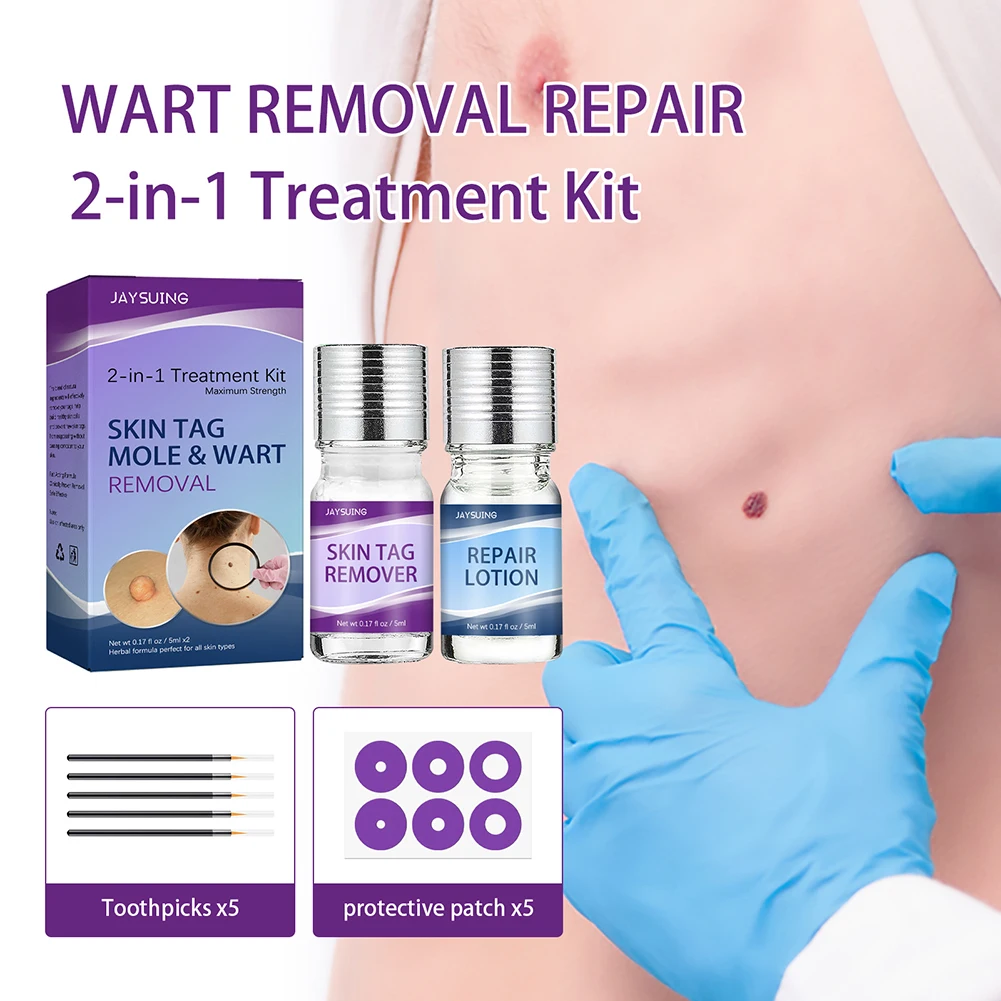 Unisex Warts Remover Liquid Wart Skin Tag Repair Treatment Sticks Aloe Vera Extract Remove Flesh Thorns Calluses Care Tools
Unisex Warts Remover Liquid Wart Skin Tag Repair Treatment Sticks Aloe Vera Extract Remove Flesh Thorns Calluses Care Tools