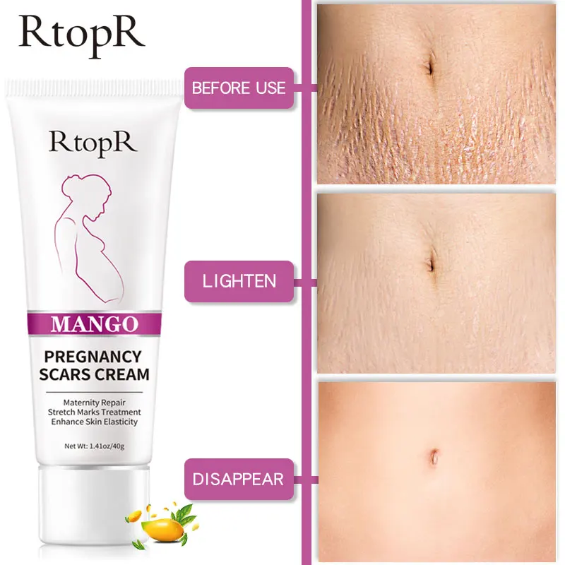 Firming Body Cream Mango Anti-Aging Cream Anti-Wrinkle Body Cream Acne Scar Removal Cream Anti-Aging Cream Anti-Wrinkle Cream
Firming Body Cream Mango Anti-Aging Cream Anti-Wrinkle Body Cream Acne Scar Removal Cream Anti-Aging Cream Anti-Wrinkle Cream