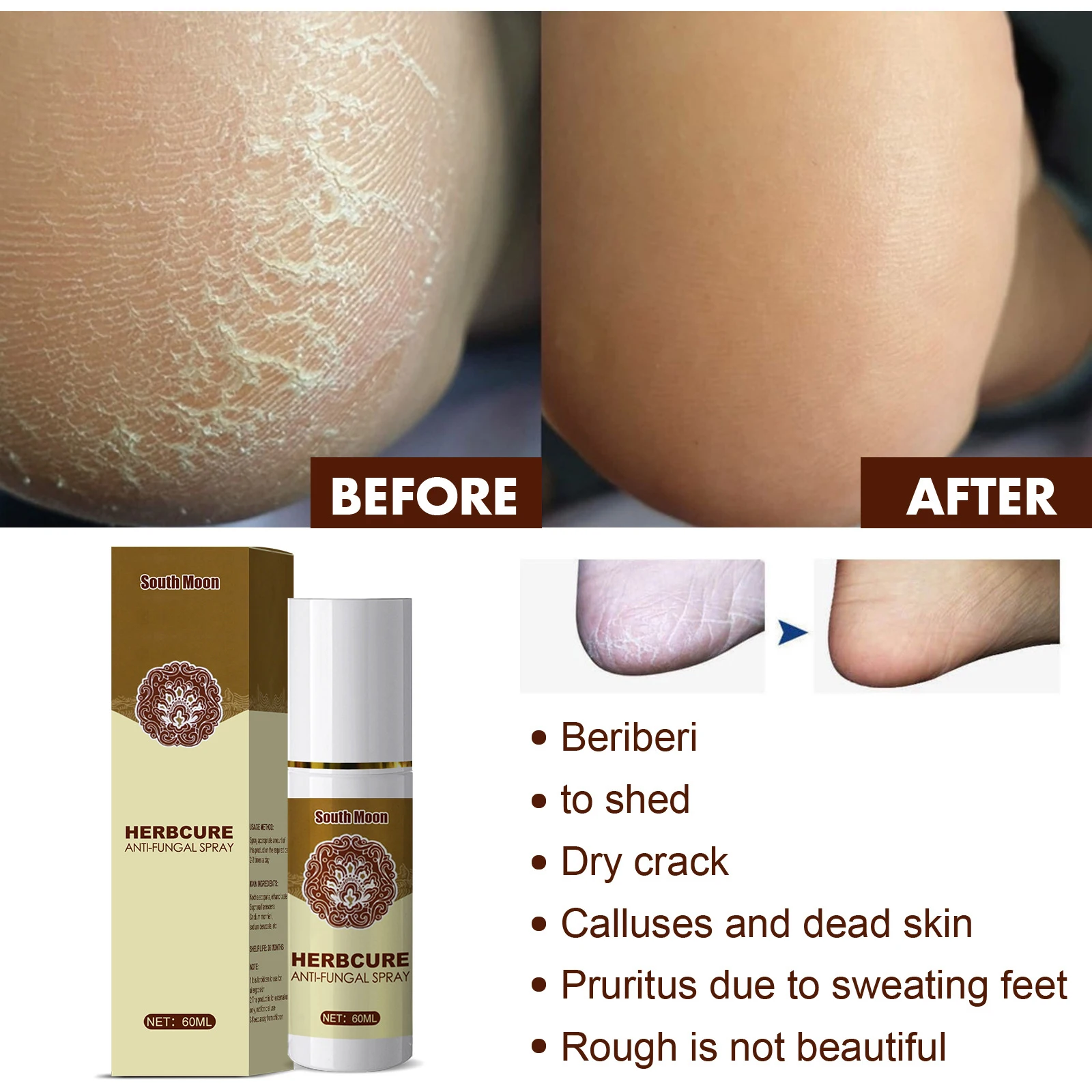 Fungal Combat Feet Spray Foot Anti Fungal Infections Athlete's Foot For Beriberi Toe Treatment Onychomycosis Anti Bacterial
Fungal Combat Feet Spray Foot Anti Fungal Infections Athlete's Foot For Beriberi Toe Treatment Onychomycosis Anti Bacterial