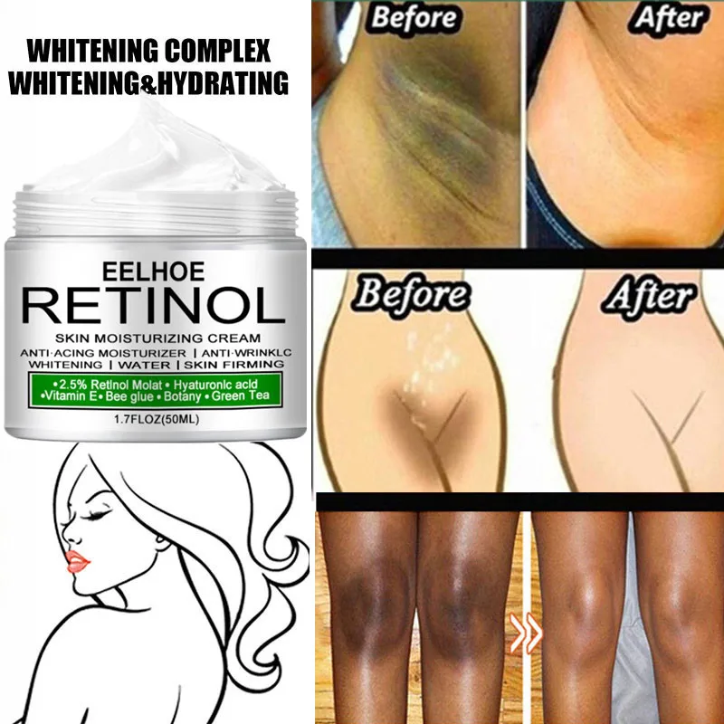 Body Whitening Cream Remove Underarm Knee Buttocks Melanin Pigmentation Improve Dull Beauty Moisturizer Brighten Body Skin Care
Body Whitening Cream Remove Underarm Knee Buttocks Melanin Pigmentation Improve Dull Beauty Moisturizer Brighten Body Skin Care
