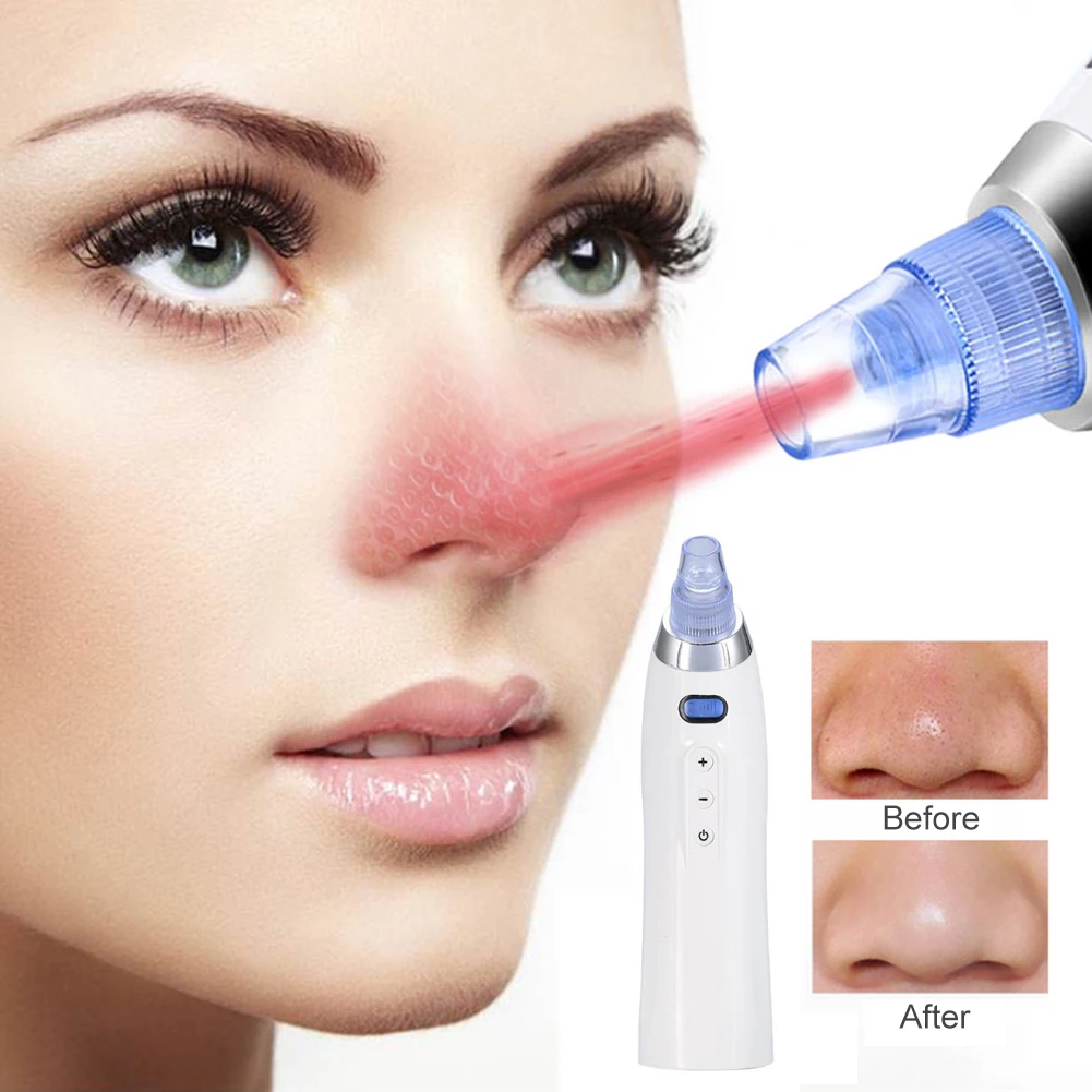USB Electric Facial Blackhead Remover Vacuum Acne Cleaner Deep Pores Cleaning Machine Pimple Acne Removal Tool Skin Care
USB Electric Facial Blackhead Remover Vacuum Acne Cleaner Deep Pores Cleaning Machine Pimple Acne Removal Tool Skin Care