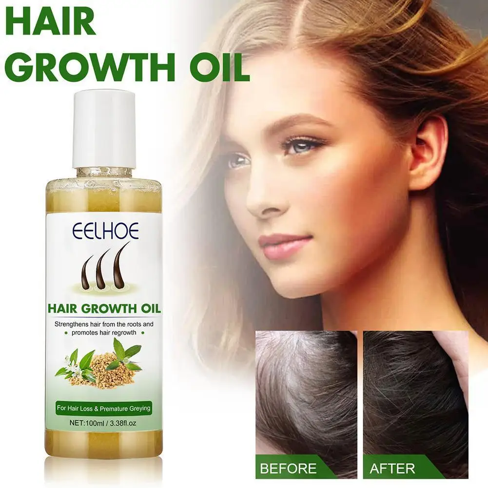 

Быстрое масло для роста волос сыворотка для восстановления роста волос лечение истончения волос жидкость для роста волос против выпадения волос для женщин и мужчин D2J5