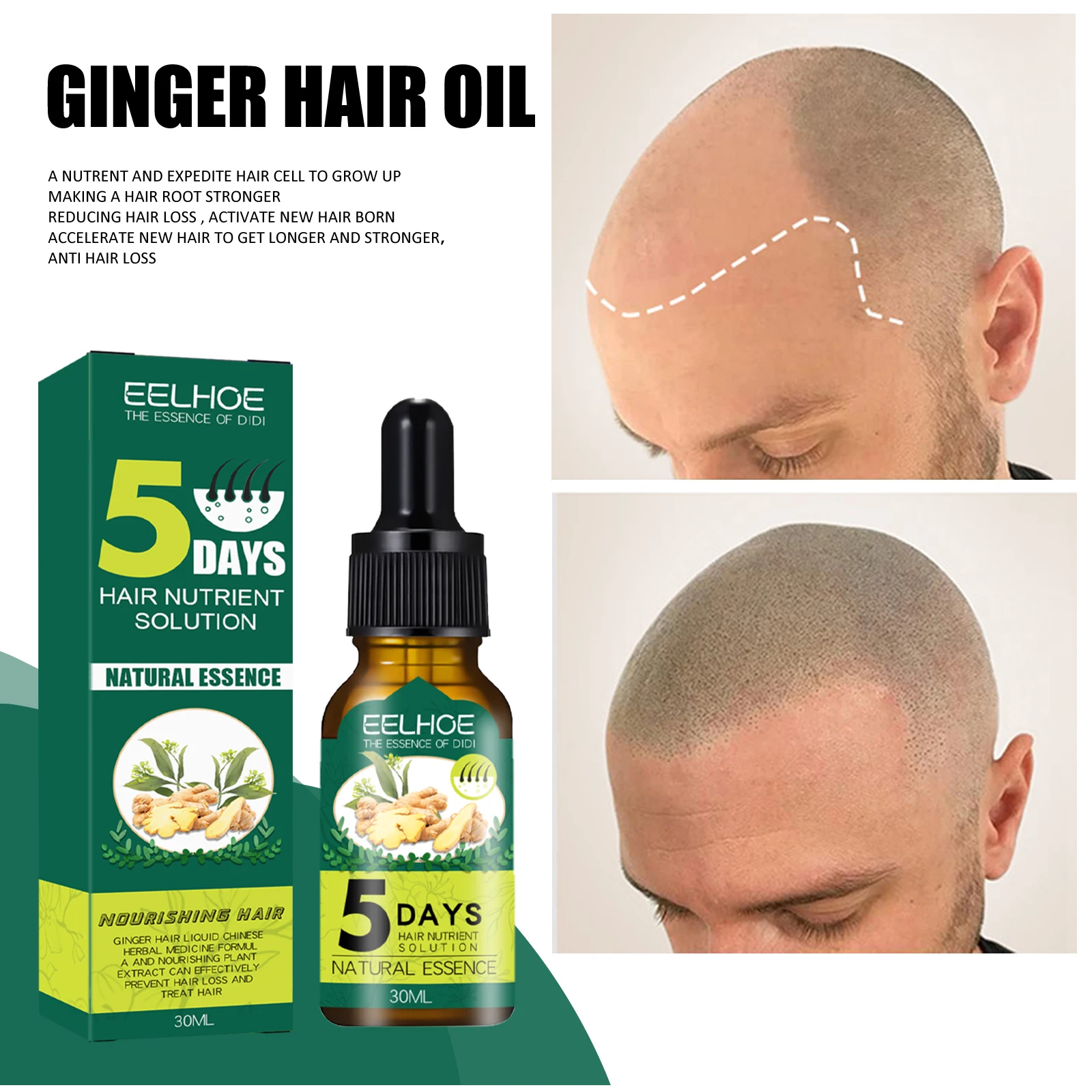 Men Women Ginger Hair Growth Essential Oil Natural Anti Hair Loss Products Fast Grow Prevent Baldness Treatment Germinal Liquid
Men Women Ginger Hair Growth Essential Oil Natural Anti Hair Loss Products Fast Grow Prevent Baldness Treatment Germinal Liquid