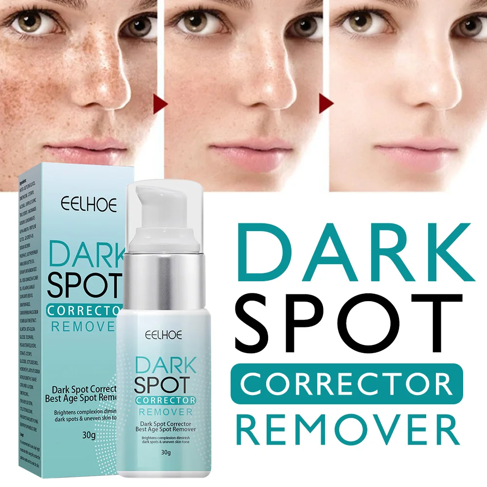 Whitening Freckle Cream Remove Dark Spots Melanin Even Skin Tone Dark Spot Corrector Skin Whitening Moisturizing Cream
Whitening Freckle Cream Remove Dark Spots Melanin Even Skin Tone Dark Spot Corrector Skin Whitening Moisturizing Cream
