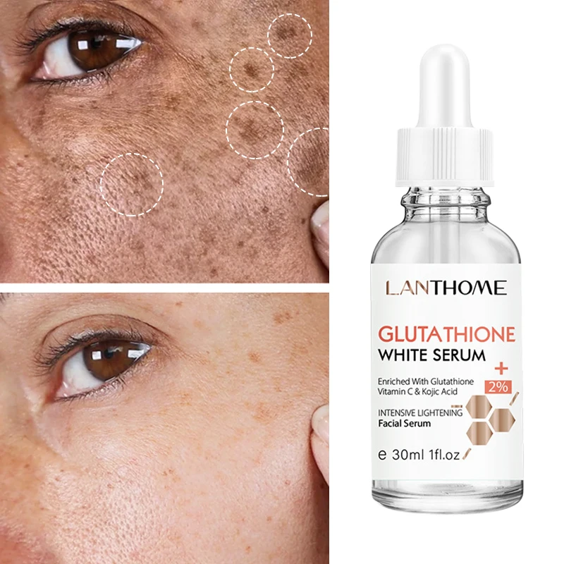 Glutathione Skin Whitening Serum Moisturizing Facial Lightening Dark Spot Stain Face Blemish Remover Korean Care Cosmetics 30ml
Glutathione Skin Whitening Serum Moisturizing Facial Lightening Dark Spot Stain Face Blemish Remover Korean Care Cosmetics 30ml