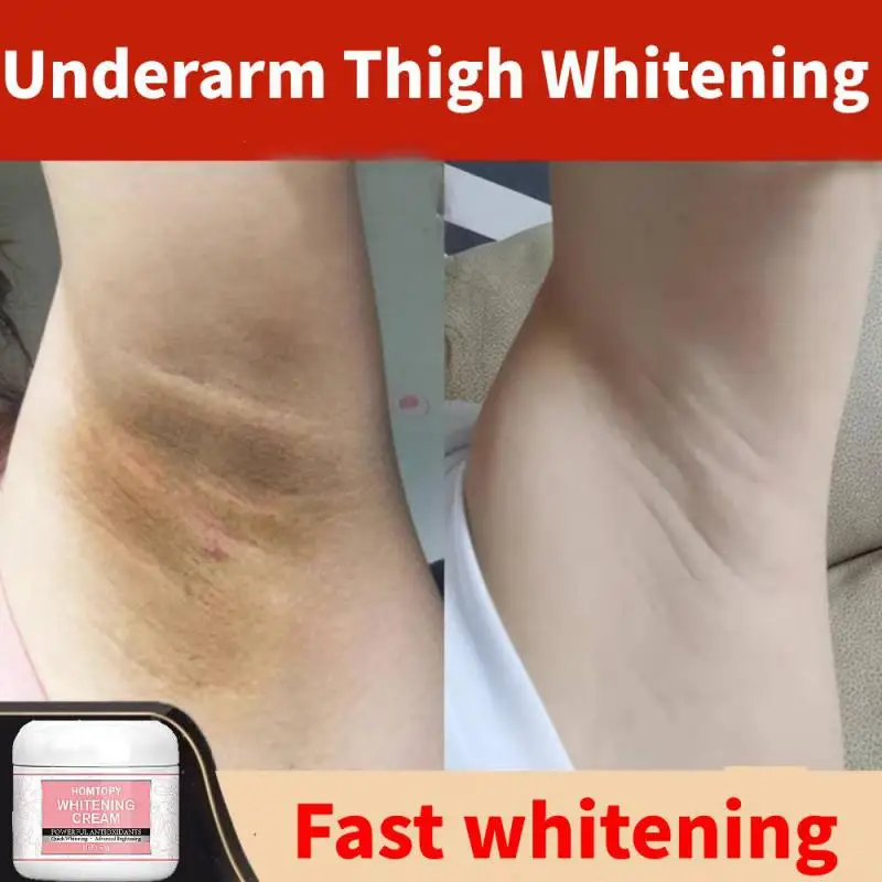 50g Underarm Whitening Cream Knee Buttocks Dark Skin Bleach Improve Melanin Pigmentation Dull Moisturizing Brighten Healthy Care
50g Underarm Whitening Cream Knee Buttocks Dark Skin Bleach Improve Melanin Pigmentation Dull Moisturizing Brighten Healthy Care