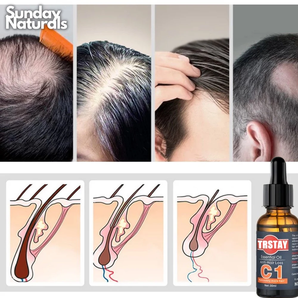 TRSTAY Hair Growth Oil Authentic Hair Grower Product C1 Anti-hair Loss Essential Oils Grow Up Serum
TRSTAY Hair Growth Oil Authentic Hair Grower Product C1 Anti-hair Loss Essential Oils Grow Up Serum
