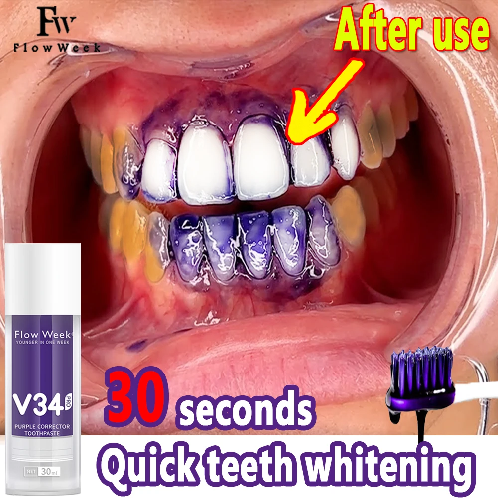 

Repair Bright White Anti-Sensitive Toothpaste Gel Gentle Whitening Toothpaste Remove Smoke Stains Plaque Fresh Breath Teeth Care