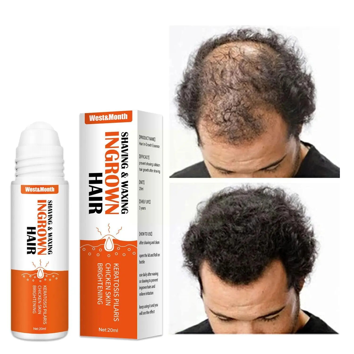 

Крем O7Y2 для удаления вросших волос, сыворотка с пробкой для лечения и уменьшения покраснения после ухода за кожей, для предотвращения бритья, 20 мл