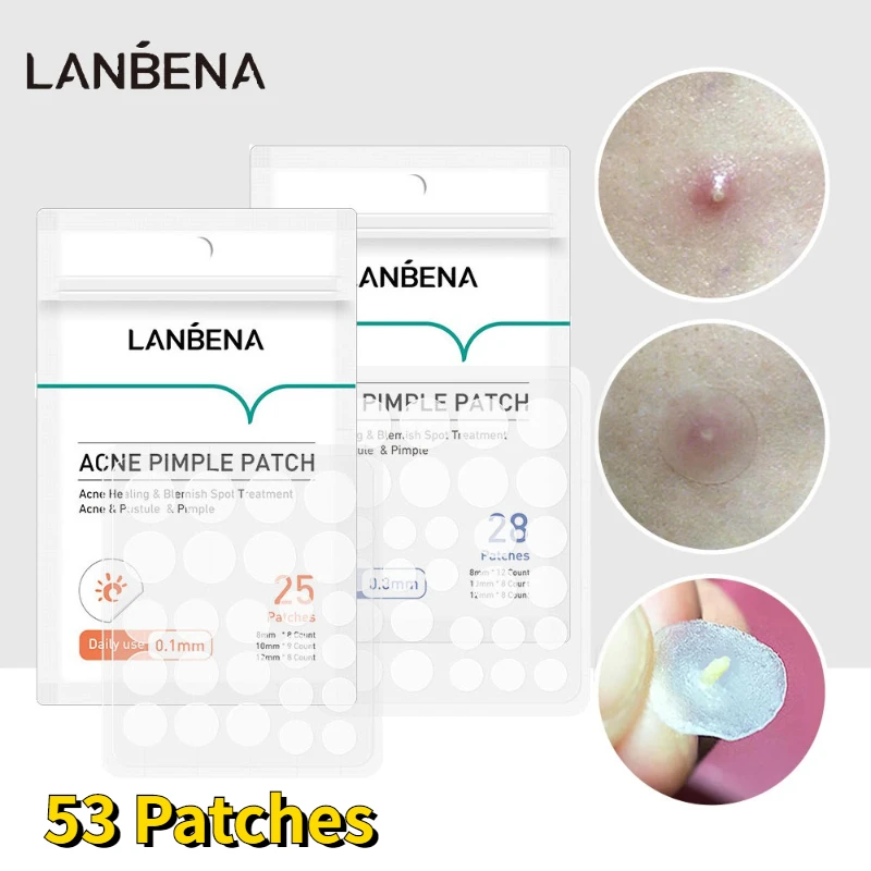 LANBENA Acne Pimple Patch Stickers Acne Treatment Pimple Remover Tool Blemish Spot Facial Mask Skin Care Waterproof 53 Patches
LANBENA Acne Pimple Patch Stickers Acne Treatment Pimple Remover Tool Blemish Spot Facial Mask Skin Care Waterproof 53 Patches