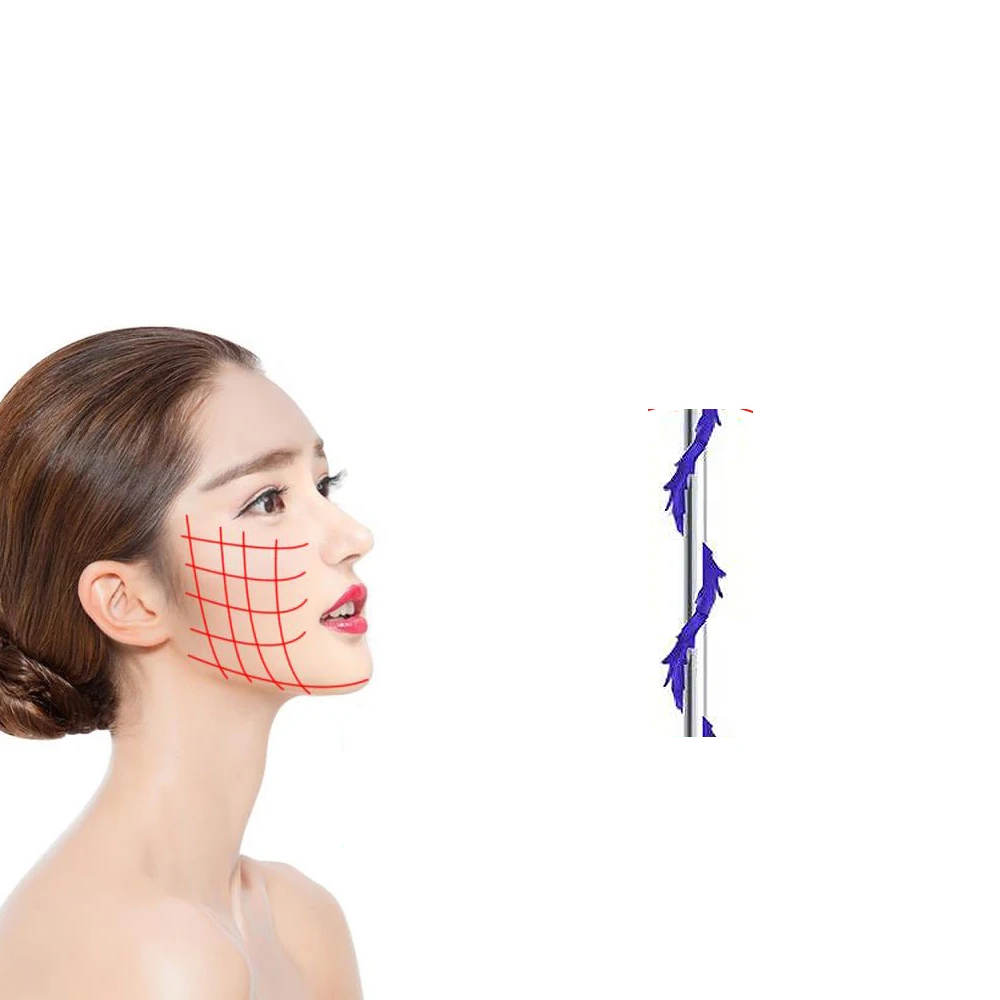 Korea Face Cog Screw Thread Lift Nose Up Eyebags Remove Wrinkle Cog Hilos Tensores Mini Pdo Thread
Korea Face Cog Screw Thread Lift Nose Up Eyebags Remove Wrinkle Cog Hilos Tensores Mini Pdo Thread