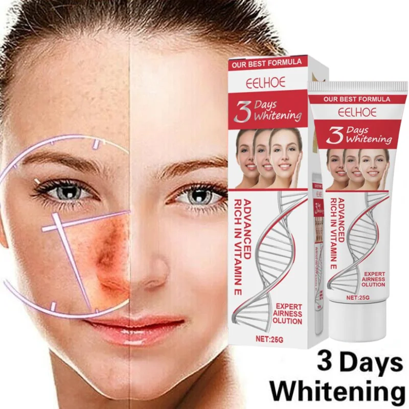 Sdotter 25g Dark Spot Removal Fade Blemish Melasma Treatment Whitening Cream Reduce Freckle Facial Care
Sdotter 25g Dark Spot Removal Fade Blemish Melasma Treatment Whitening Cream Reduce Freckle Facial Care