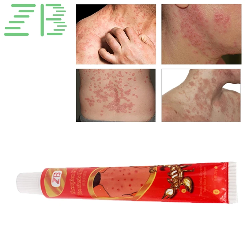 3 шт ZB 20 г китайская мазь массаж псориаси экзема крем дерматит экзематоидная экзема мазь лечение крем для ухода за кожей
3 шт ZB 20 г китайская мазь массаж псориаси экзема крем дерматит экзематоидная экзема мазь лечение крем для ухода за кожей