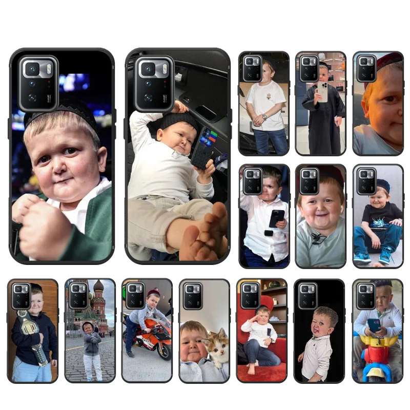 Phone Case For Xiaomi Redmi Note 12 Pro 11S 11 10 Pro 9Pro Note9 10S Redmi 10 9C Hasbulla Case
Phone Case For Xiaomi Redmi Note 12 Pro 11S 11 10 Pro 9Pro Note9 10S Redmi 10 9C Hasbulla Case
