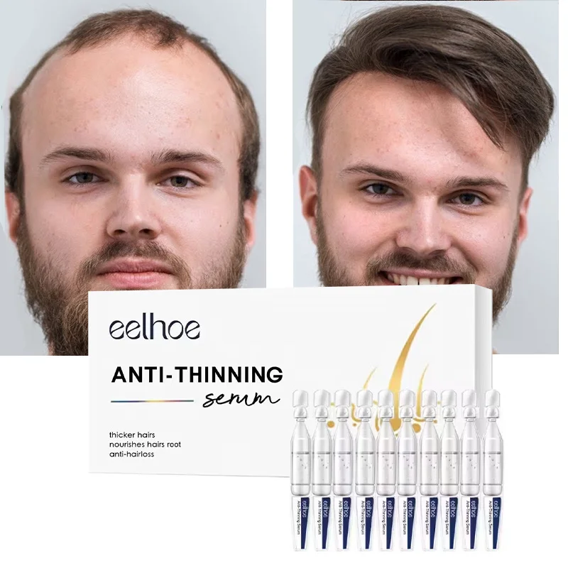 Hair Growth Serum Anti Hair Loss Treatment Fast Regrowth Thicker Prevent Baldness Repair Dry Damaged Nourishing Scalp Hair Care
Hair Growth Serum Anti Hair Loss Treatment Fast Regrowth Thicker Prevent Baldness Repair Dry Damaged Nourishing Scalp Hair Care