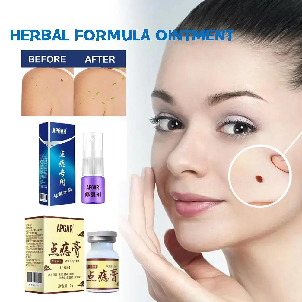 

Lightening Face Cream Freckles Cream Age Spots Removal Skin Care Dark Spots Melasma Lightening Herbal Formula Ointment 5g