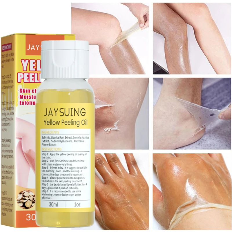 Yellow Peeling Oil Dark Skin Bleaching Remove Arm Knee Legs Melanin Body Brighten Scrub Exfoliating Dead Skin Care Whiten Serum
Yellow Peeling Oil Dark Skin Bleaching Remove Arm Knee Legs Melanin Body Brighten Scrub Exfoliating Dead Skin Care Whiten Serum
