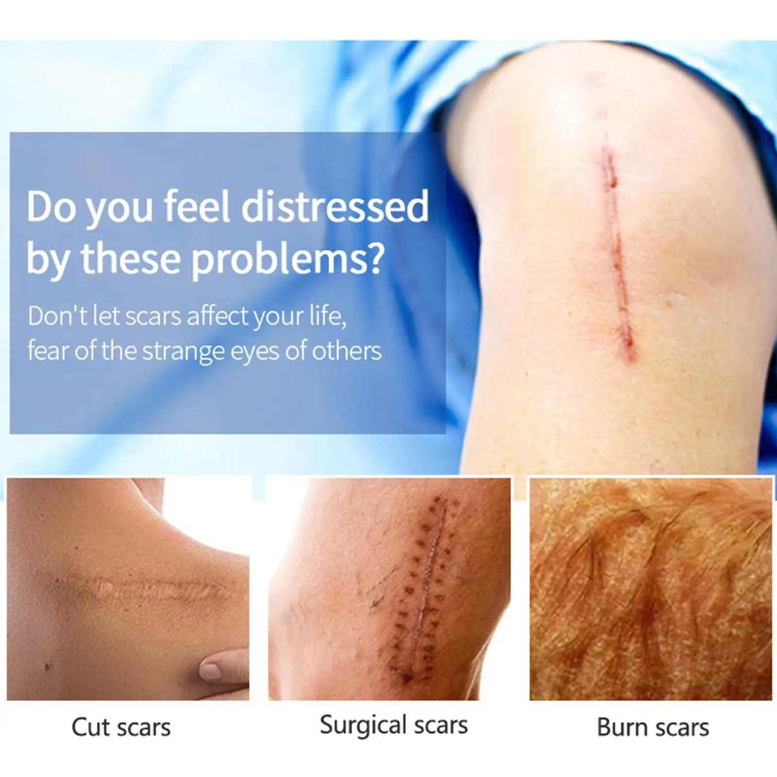 Крем для удаления шрамов, бриллиантовое лечение, хирургические следы, красота кожи, растяжение, отбеливание, сглаживание шрамов, ремонт, ожог W4U1
Крем для удаления шрамов, бриллиантовое лечение, хирургические следы, красота кожи, растяжение, отбеливание, сглаживание шрамов, ремонт, ожог W4U1