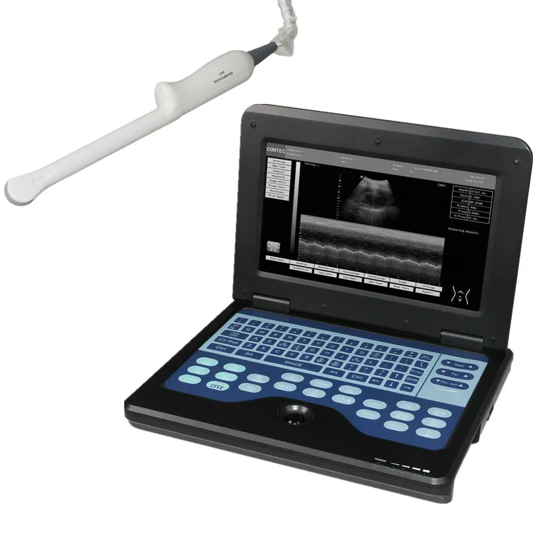 CONTEC CMS600P2 ultrasound scanner laptop machine ultrasonic diagnostic systems with 6.5Mhz Transvaginal probe
CONTEC CMS600P2 ultrasound scanner laptop machine ultrasonic diagnostic systems with 6.5Mhz Transvaginal probe