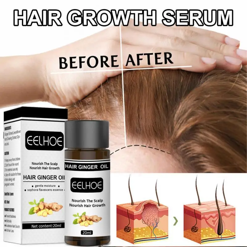Hair Care Hair Growth Products Fast Growing Hair Oil Hair Loss Care Liquid Beauty Hair & Scalp Treatment Dense Hair Growth Serum
Hair Care Hair Growth Products Fast Growing Hair Oil Hair Loss Care Liquid Beauty Hair & Scalp Treatment Dense Hair Growth Serum