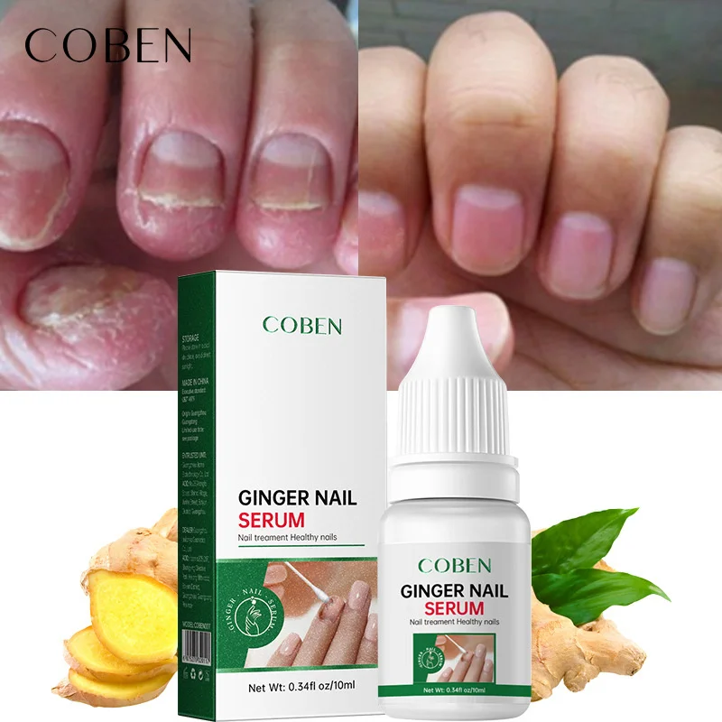 Fungal Nail Treatment Serum Remove Onychomycosis Softening Repair Cracked Nails Nail Cuticle Regrowth Remedy Oil Toenails Care 
Fungal Nail Treatment Serum Remove Onychomycosis Softening Repair Cracked Nails Nail Cuticle Regrowth Remedy Oil Toenails Care
