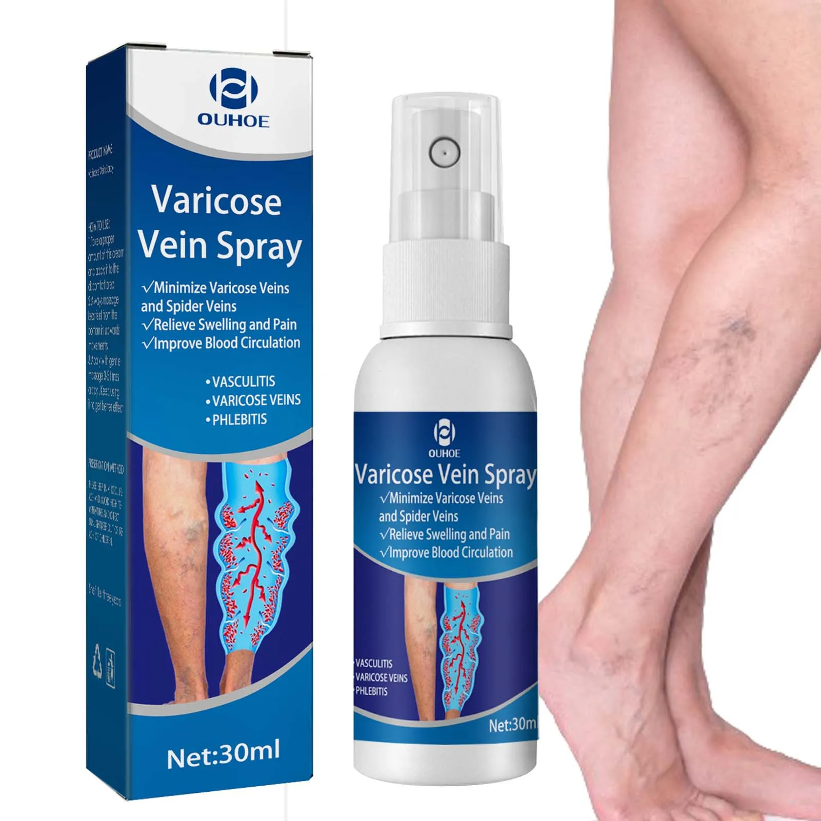 Спрей для лечения варикозного расширения вен, 1,05 унции 
Спрей для лечения варикозного расширения вен, 1,05 унции