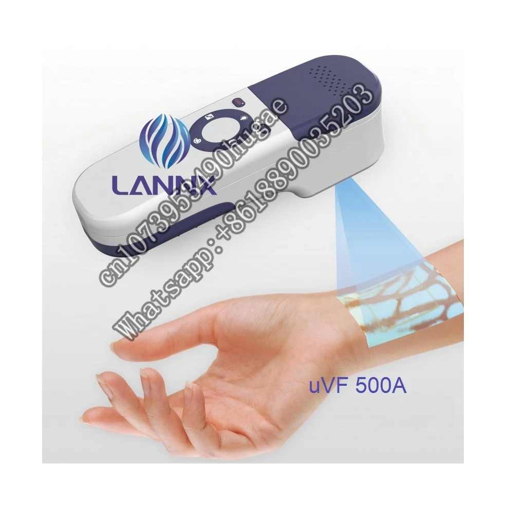 

LANNX uVF 500A Medical vein finder for blood collection needles puncture Locate veins Hospital Scanner Test vein finder detector