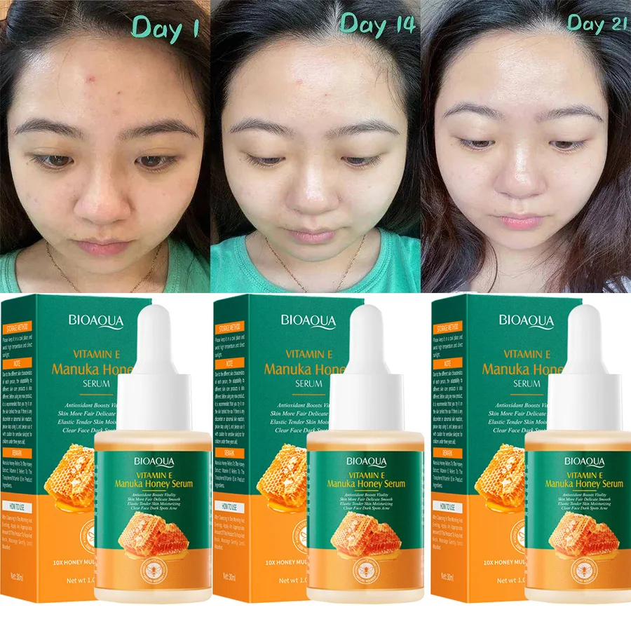 Vitamin E Manuka Honey Gold Face Serum Repairing Essence Moisturizing Oil Control Shrink Pores Lifing Anti-wrinkle Face Serum
Vitamin E Manuka Honey Gold Face Serum Repairing Essence Moisturizing Oil Control Shrink Pores Lifing Anti-wrinkle Face Serum