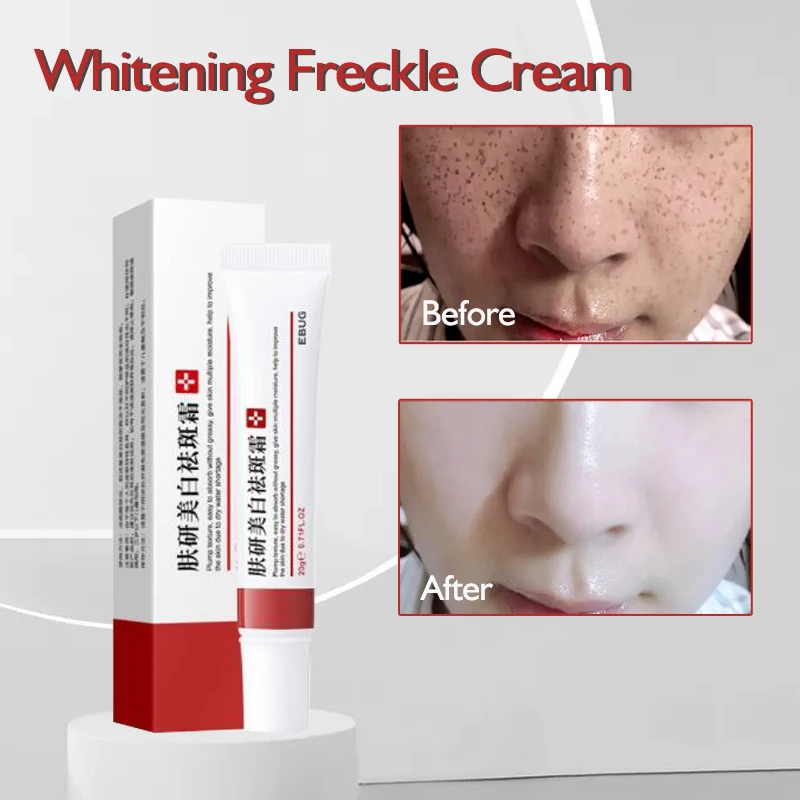 Whitening Freckle Cream Remove Brighten Skin Dark Spots Melasma Pigment Melanin Removal Acne Spot Pigmentation Face Care 20g
Whitening Freckle Cream Remove Brighten Skin Dark Spots Melasma Pigment Melanin Removal Acne Spot Pigmentation Face Care 20g