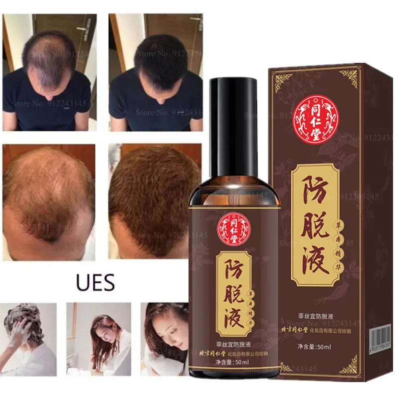 Tongrentang Anti-alopecia Hair-fixing Hair-raising Strong Hair 7-day Effective Hair Growth Repair Growth Treatment Solution 50ml
Tongrentang Anti-alopecia Hair-fixing Hair-raising Strong Hair 7-day Effective Hair Growth Repair Growth Treatment Solution 50ml