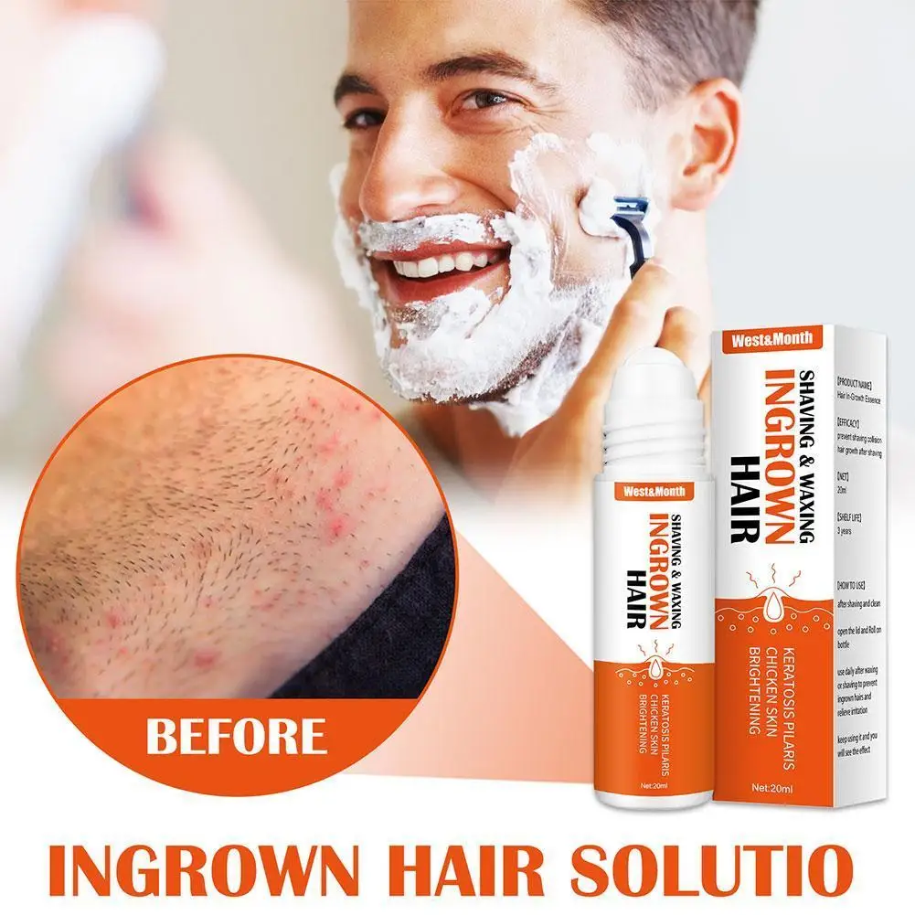 Razor Bumps Removal Solution Ingrowns Hair Treatment After Shave Repair Dark Spot Reduce Redness Serum for Vanish PFB Skin Care
Razor Bumps Removal Solution Ingrowns Hair Treatment After Shave Repair Dark Spot Reduce Redness Serum for Vanish PFB Skin Care