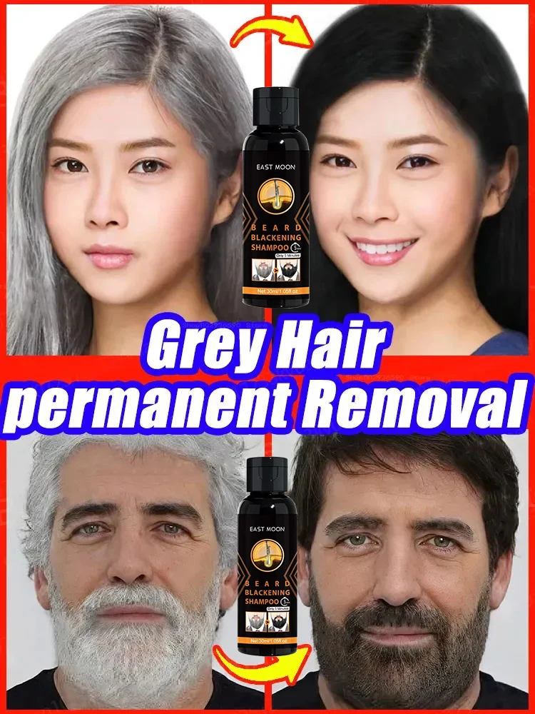 

Сыворотка для лечения белых волос, восстановление от белого до черного, естественный цвет, питание, против седых волос