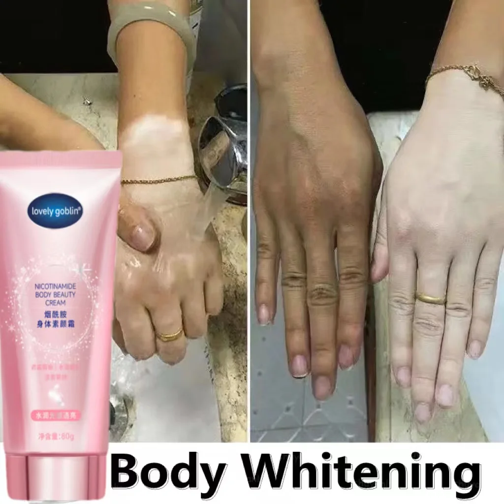 Whitening Refreshing Body Lotion Non-sticky Fade Melanin Underarm Skin Care Body Whitening Cream Light Fragrance Beauty Health
Whitening Refreshing Body Lotion Non-sticky Fade Melanin Underarm Skin Care Body Whitening Cream Light Fragrance Beauty Health