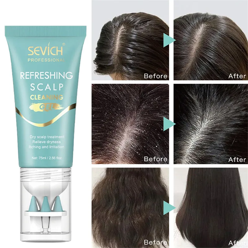 Refreshing Scalp Cleansing Gel Anti-Dandruff Exfoliating Nourishing Hair Care Soothing Massage Treatments Anti-hair Loss Spray
Refreshing Scalp Cleansing Gel Anti-Dandruff Exfoliating Nourishing Hair Care Soothing Massage Treatments Anti-hair Loss Spray