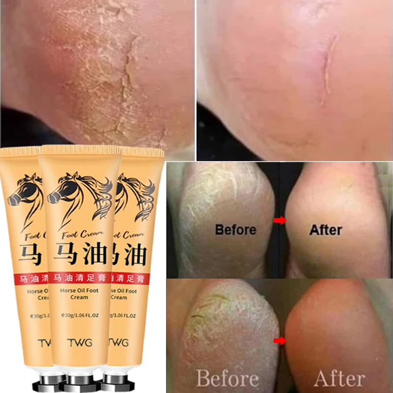 Anti-Crack Foot Cream Anti-Drying Heel Cracked Repair Cream Removal Dead Moisturizes Horse Oil Strong Effective Foot Care Cream
Anti-Crack Foot Cream Anti-Drying Heel Cracked Repair Cream Removal Dead Moisturizes Horse Oil Strong Effective Foot Care Cream