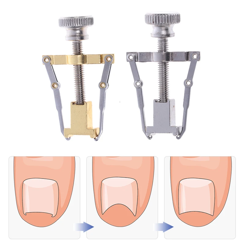Ingrown Toenails Correction Tool Foot Toe Nail Care Tools Straightening Clip Brace Corrector Feet Pedicure Treatment Adjuster
Ingrown Toenails Correction Tool Foot Toe Nail Care Tools Straightening Clip Brace Corrector Feet Pedicure Treatment Adjuster