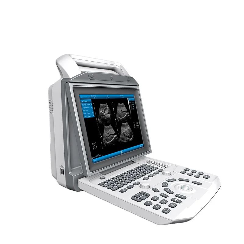 Portable ultrasound machines PBWU50 Imaging PW doppler ultrasound scanner medical ultrasound instruments
Portable ultrasound machines PBWU50 Imaging PW doppler ultrasound scanner medical ultrasound instruments