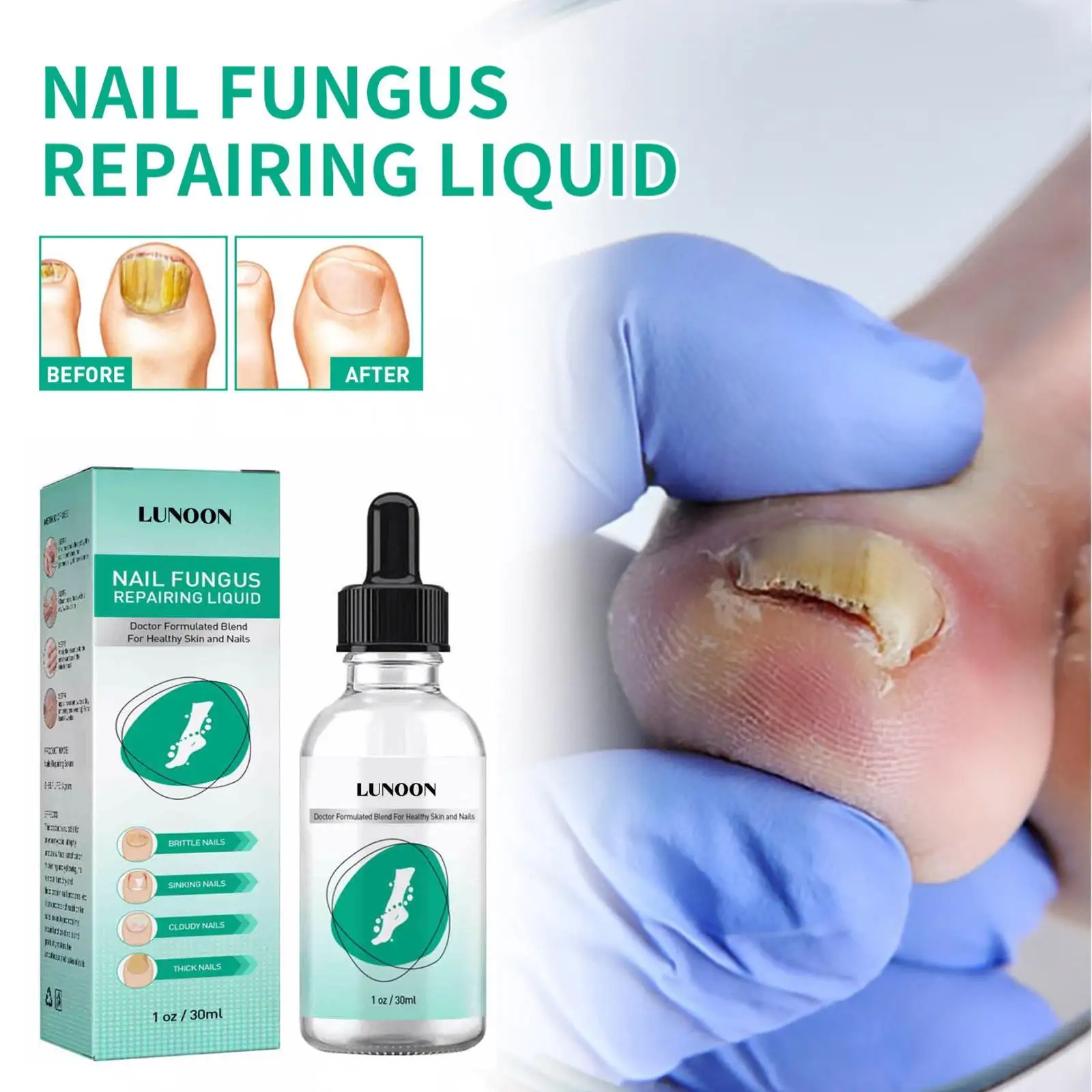 30ml Nail Fungus Treatment Essence Serum Care Hand Foot Care Removal Repair Ringworm of The Nails Gel Anti-infective Hot
30ml Nail Fungus Treatment Essence Serum Care Hand Foot Care Removal Repair Ringworm of The Nails Gel Anti-infective Hot