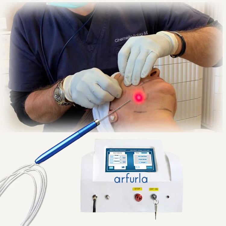 Arfurla 980nm 1470nm Laser Face Slimming Liposuction Device Slimming Lipolysis Machine
Arfurla 980nm 1470nm Laser Face Slimming Liposuction Device Slimming Lipolysis Machine