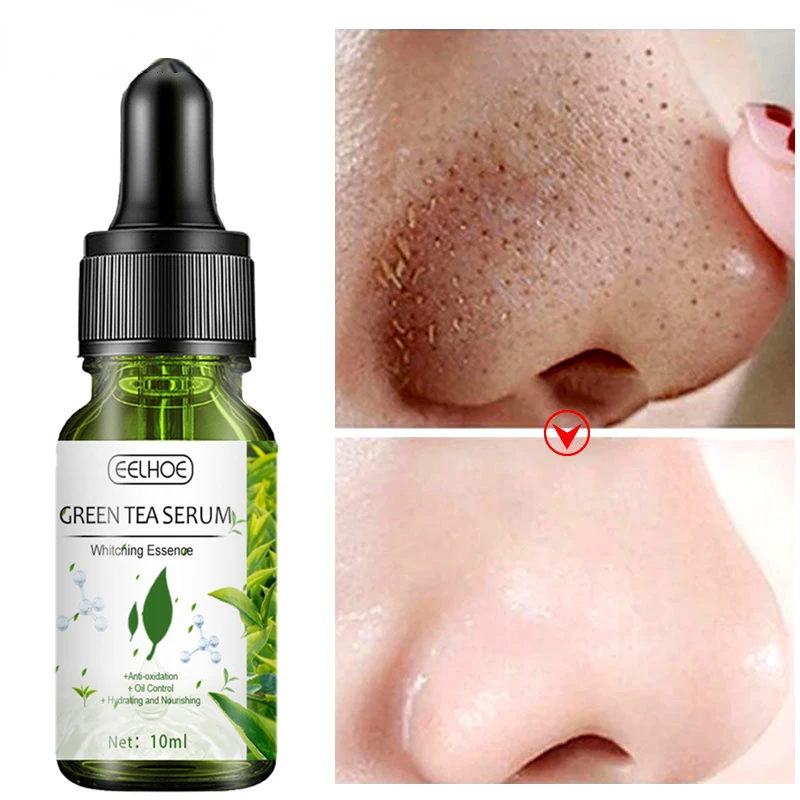 Корейская Сыворотка для уменьшения пор и ухода за кожей лица с зеленым чаем
Корейская Сыворотка для уменьшения пор и ухода за кожей лица с зеленым чаем