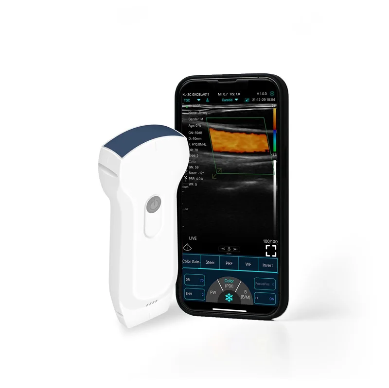 Ultrasound Wifi Medical Portable USB Linear Ultrasound Probe Portable Handheld Ultrasound Scanner
Ultrasound Wifi Medical Portable USB Linear Ultrasound Probe Portable Handheld Ultrasound Scanner