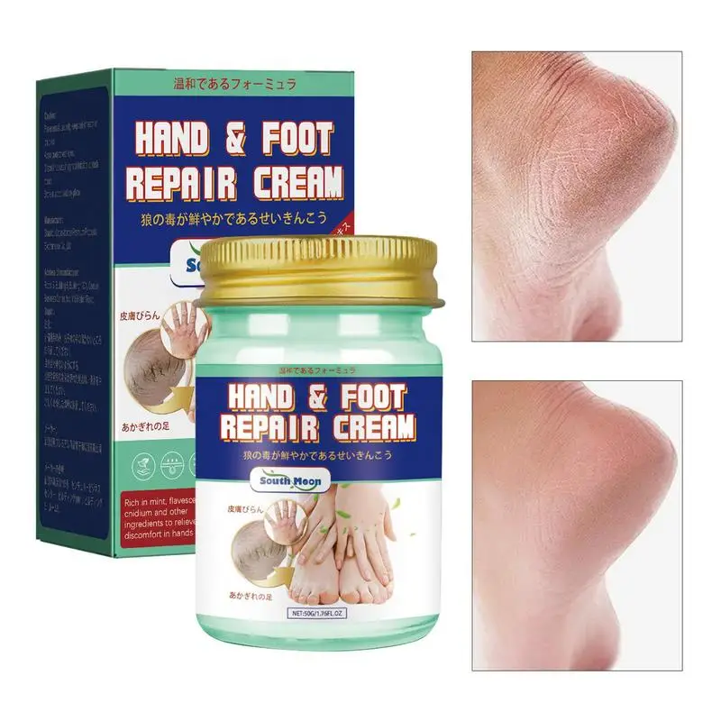 Hand Cream For Women Hand Foot Lotion For Dry Cracked Feet Foot Care Heals And Moisturizes For Healthy Feet Cracked Heel Product
Hand Cream For Women Hand Foot Lotion For Dry Cracked Feet Foot Care Heals And Moisturizes For Healthy Feet Cracked Heel Product