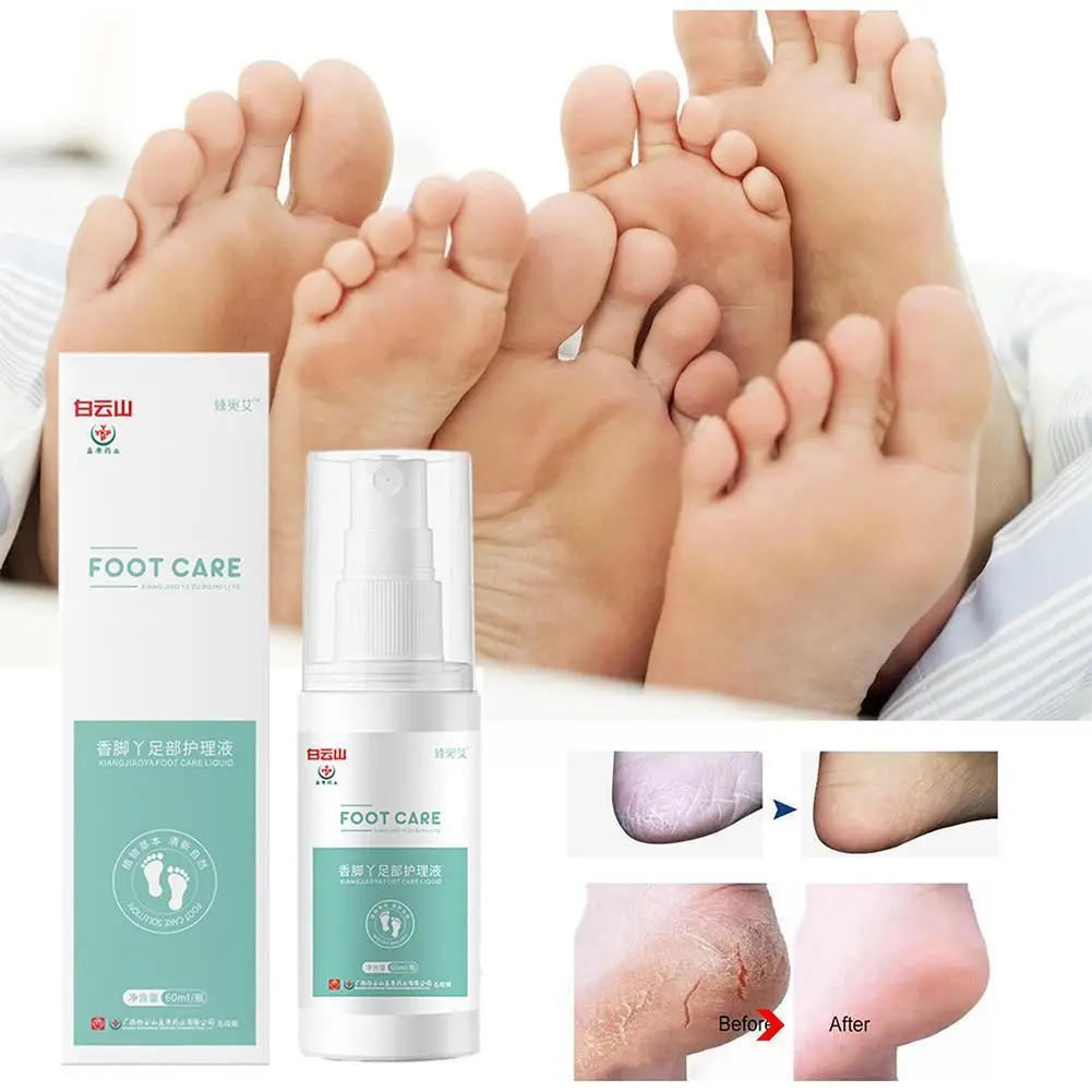 Herbal Fragrance Foot Deodorizing Spray Herbaceous Shoe Care Anti Fresheners Extract Removal Odor And Foot Plant Cure Crack C5E5
Herbal Fragrance Foot Deodorizing Spray Herbaceous Shoe Care Anti Fresheners Extract Removal Odor And Foot Plant Cure Crack C5E5