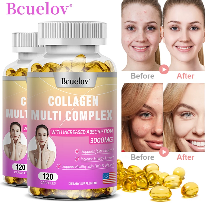 Bcuelov Hydrolyzed Collagen Peptide Supplement - Support shiny skin healthy joints hair and nails anti-aging whitening for women
Bcuelov Hydrolyzed Collagen Peptide Supplement - Support shiny skin healthy joints hair and nails anti-aging whitening for women