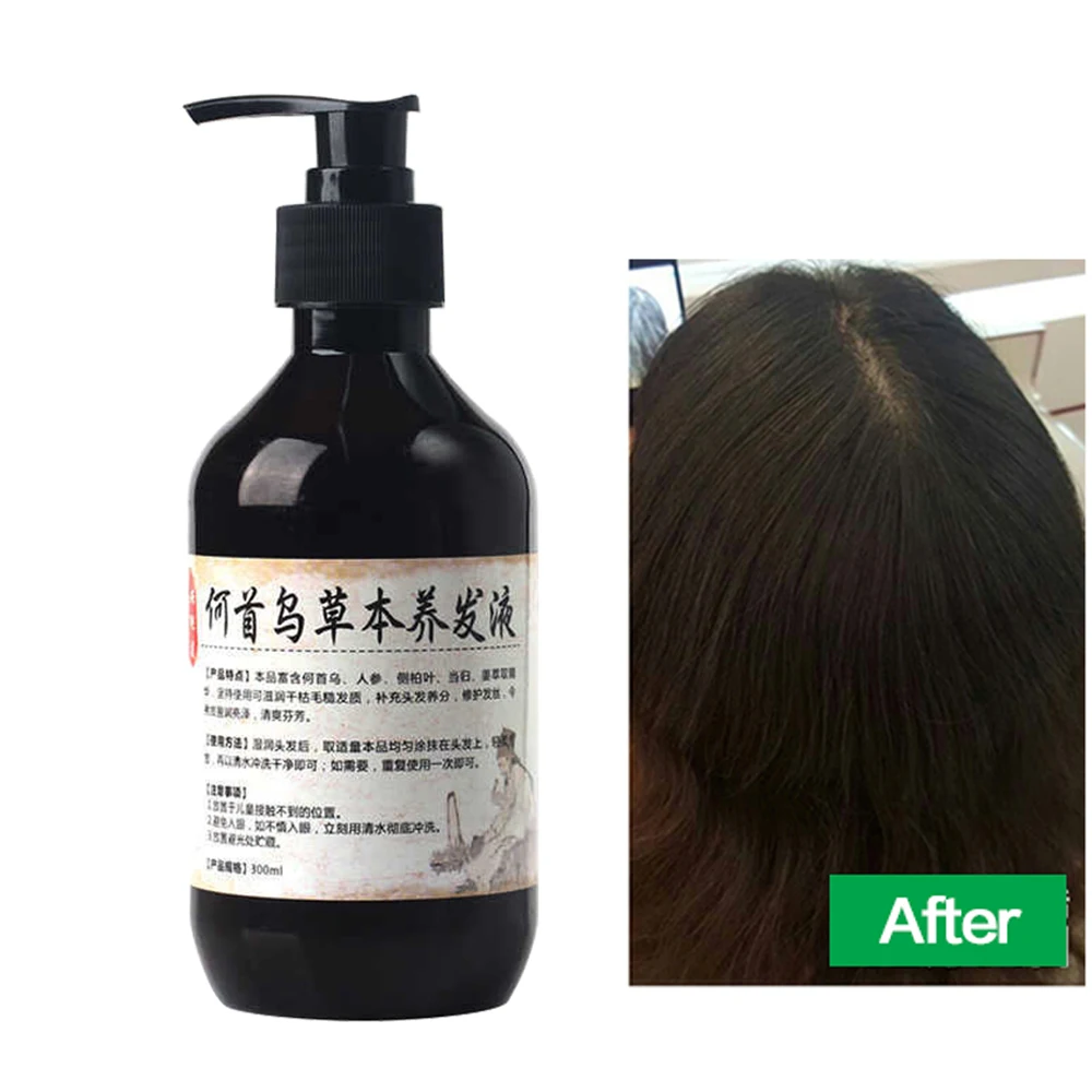 Травяной натуральный шампунь Polygonum Multiflorum, растительный жидкий седый волос, белый, удаление волос, постоянная работа, уход за черными волоса...
Травяной натуральный шампунь Polygonum Multiflorum, растительный жидкий седый волос, белый, удаление волос, постоянная работа, уход за черными волоса...